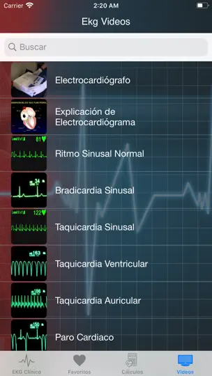 Captura de pantalla de EKG Clínico en iPhone 8