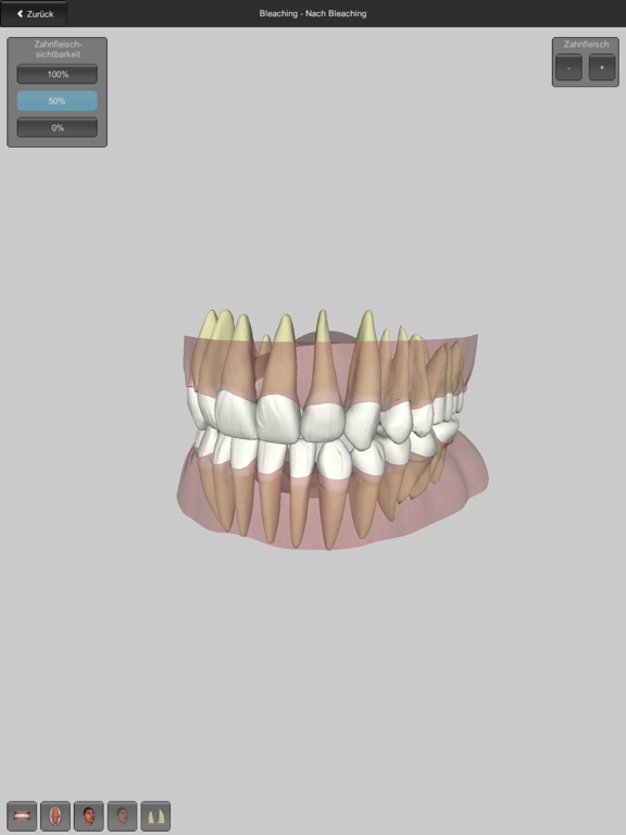 Screenshot #6 pour CGM VISODENT 3D App