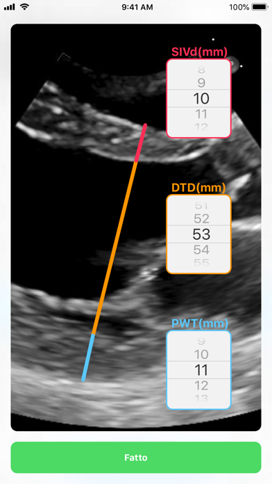 Screenshot #3 pour LVG Calc