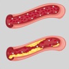 Peripheral Vascular Disease icon