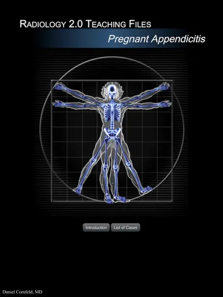 Pregnant Appendicitis