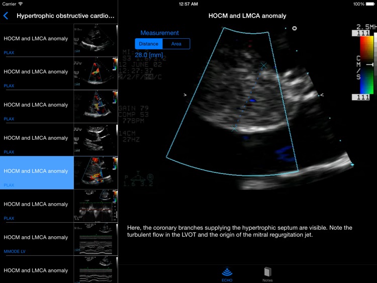 CARDIO3®Echocardiography HD screenshot-0