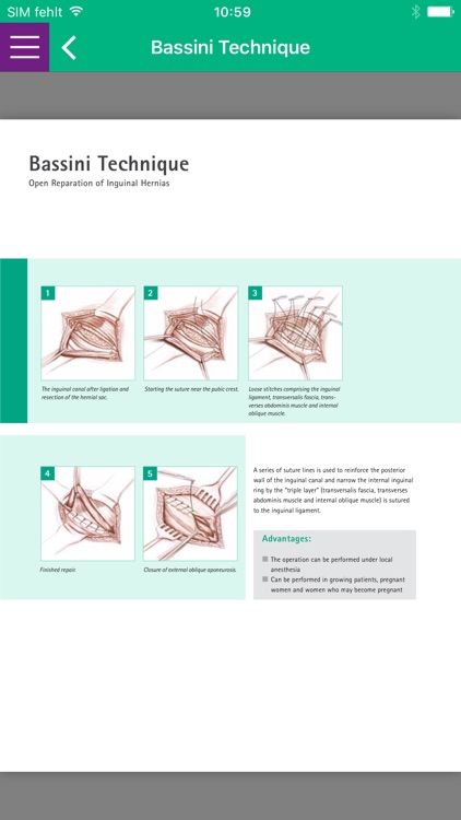 B. Braun Abdominal Wall Health screenshot-3