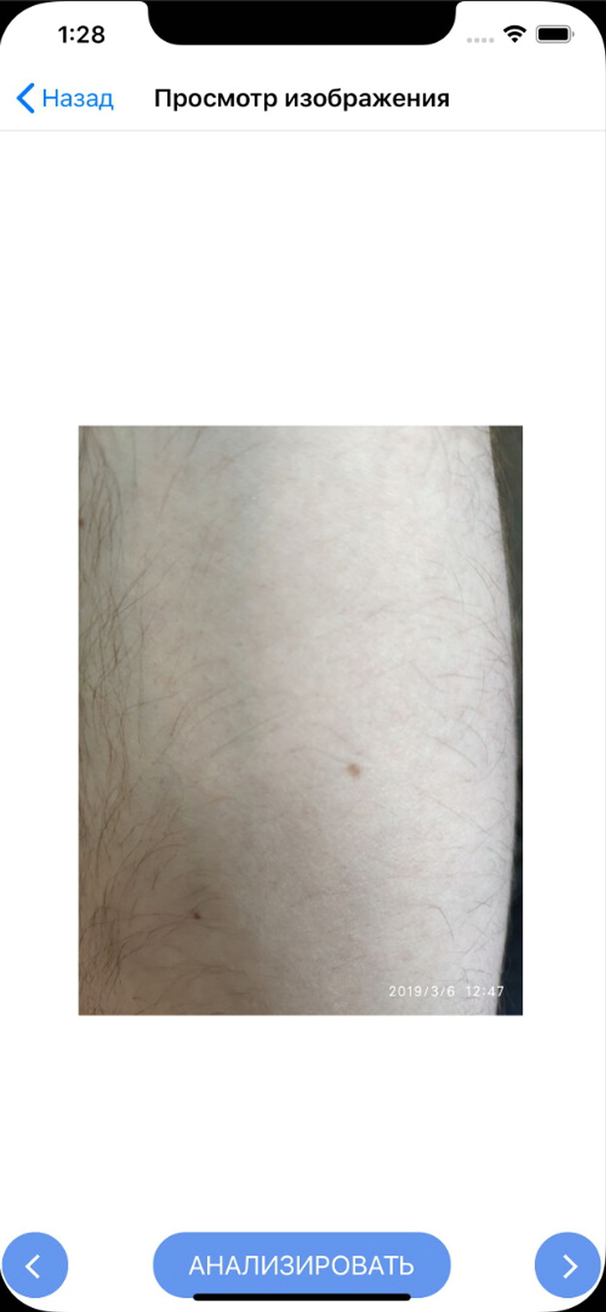 DermaScan for doctors screenshot 9
