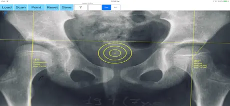 CenterEdgeAngleApp