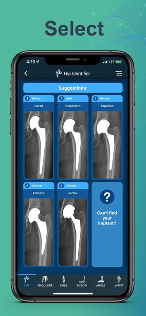 Implant Identifier(圖5)-速報App