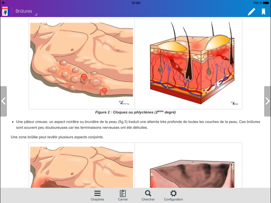 Screenshot #4 pour GOSAP BMPM