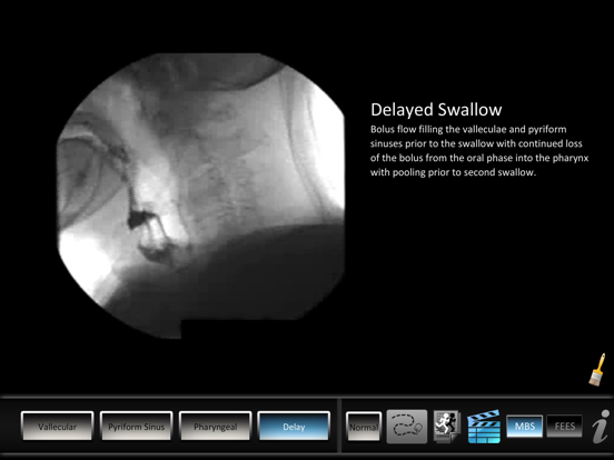 Screenshot #6 pour Residue Disorders
