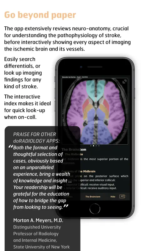 Radiology - Imaging in Stroke screenshot 2 of 5