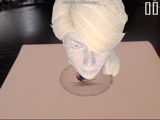 Screenshot #6 pour Diabetic Retinopathy AR