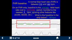Fetal Heart Rate - SecondLook iPhone image 3