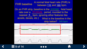 Fetal Heart Rate - SecondLook screenshot
