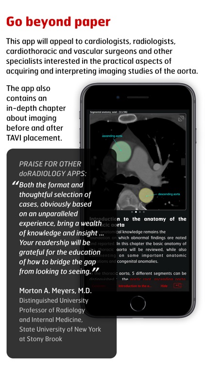 Radiology - Aortic Imaging