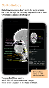 Radiology - Head&Neck Anatomy screenshot