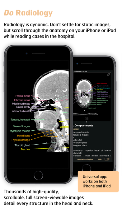 Radiology - Head&Neck Anatomy screenshot 3