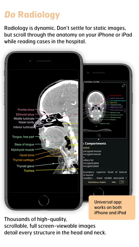 Radiology - Head&Neck Anatomy screenshot 3 of 4