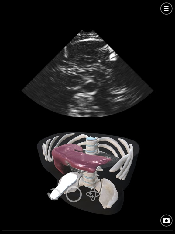 Screenshot #4 pour Deepscope Ultrasound Simulator