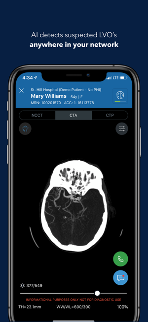 Viz Training AI Stroke Care(圖2)-速報App