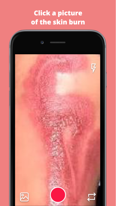 Screenshot #1 pour Burn AI