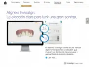 invisalign pro consultation ipad capturas de pantalla 2