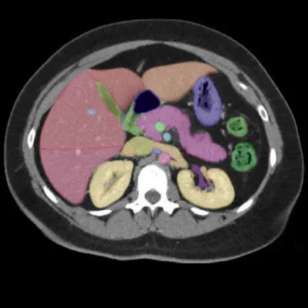 Anatomy on Radiology CT Cheats