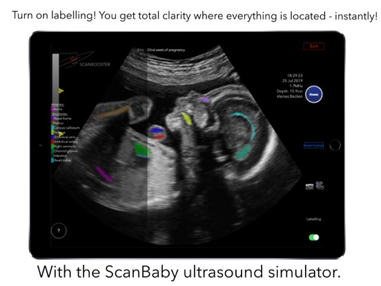 ScanBaby 赤ちゃんの超音波を学ぶのおすすめ画像5