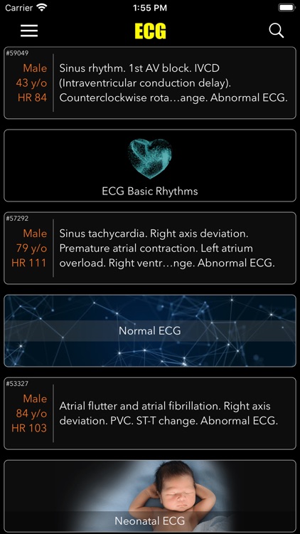 ECG / EKG