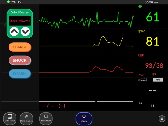 Simpl Patient Monitor iPad screenshot 5 - Medical app