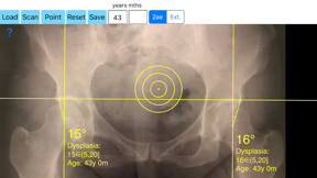 CenterEdgeAngleApp screenshot