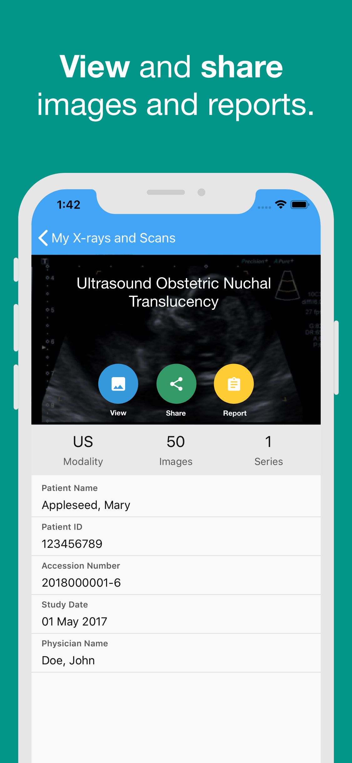 FSR Patient