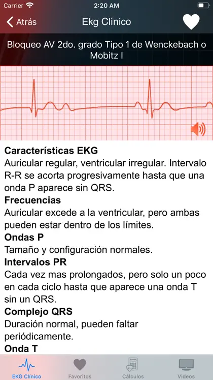 Screenshot 4 di 6 di EKG Clínico