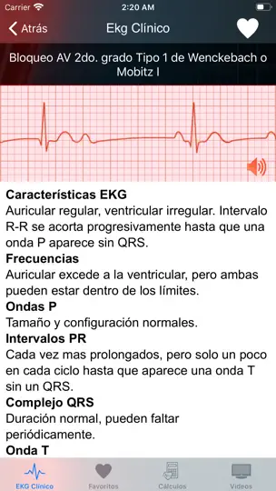 Captura de pantalla de EKG Clínico en iPhone 4