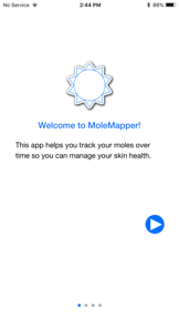 Mole Mapper Melanoma Study screenshot