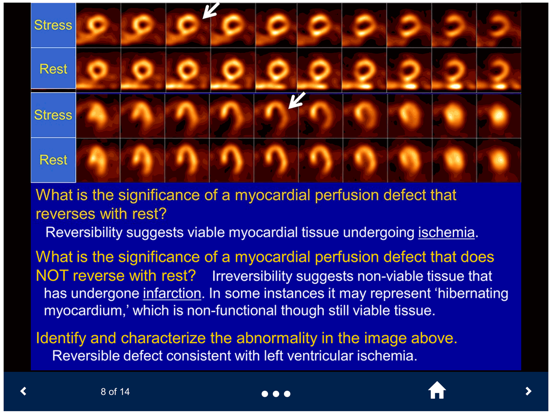 Basic Radiology - SecondLook iPad screenshot 5 - Medical app