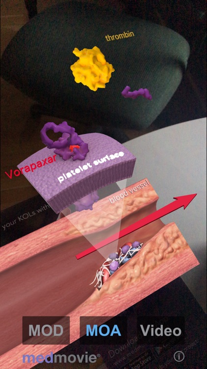 Medmovie AR1