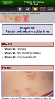 pediatric dermatology ddx deck iphone screenshot 3