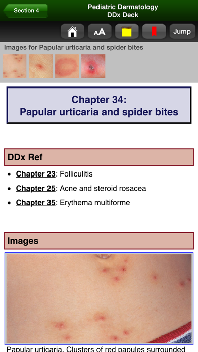 Screenshot #3 pour Pediatric Dermatology DDx Deck