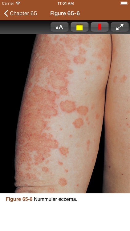 Johns Hopkins Internal Med 5/E screenshot-8