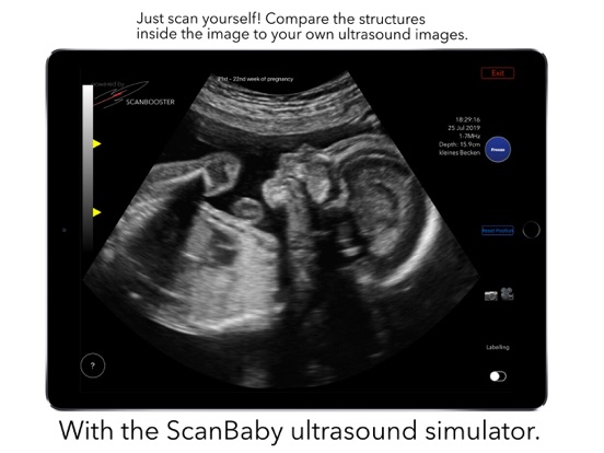 ScanBaby 赤ちゃんの超音波を学ぶのおすすめ画像2