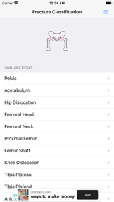 Fracture Classification (FC) screenshot