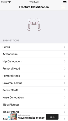 Fracture Classification (FC) screenshot 5