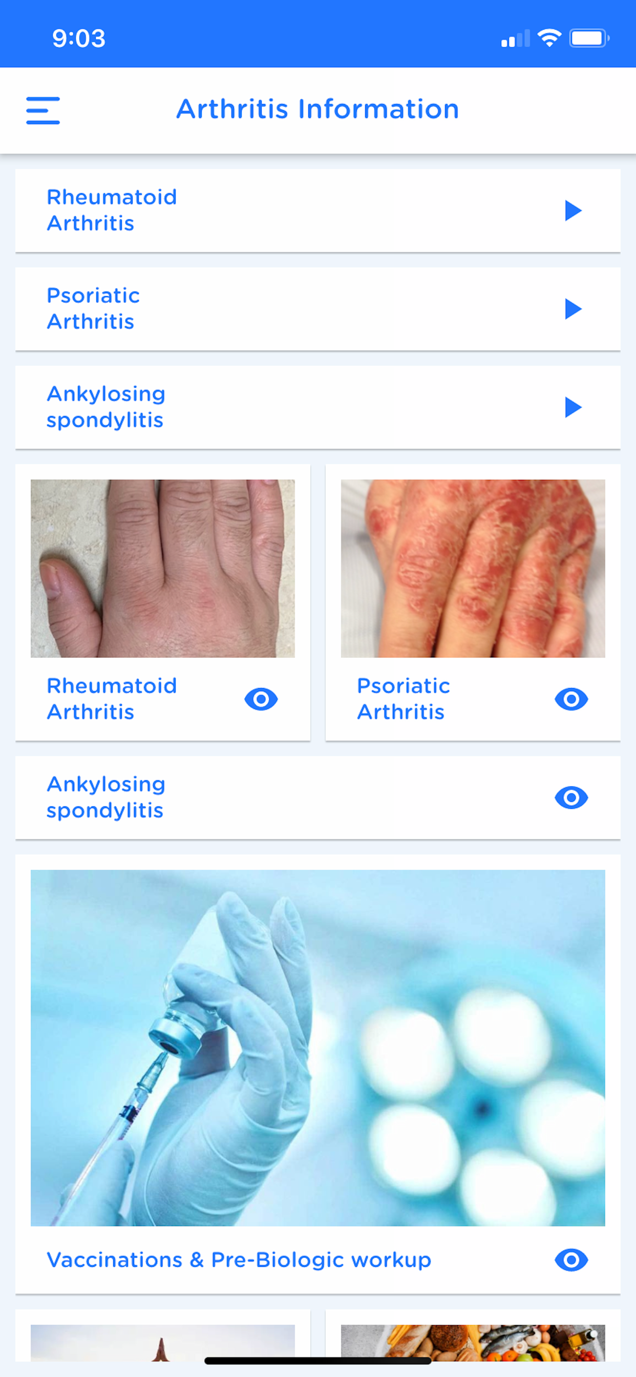 Arthritis+ Patient