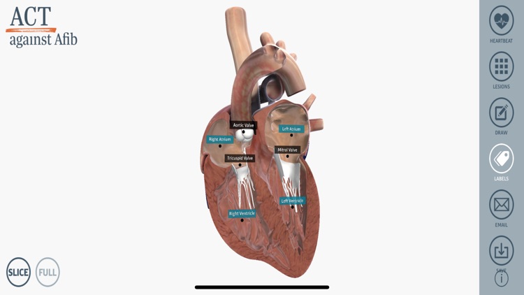 ACT 3D Heart