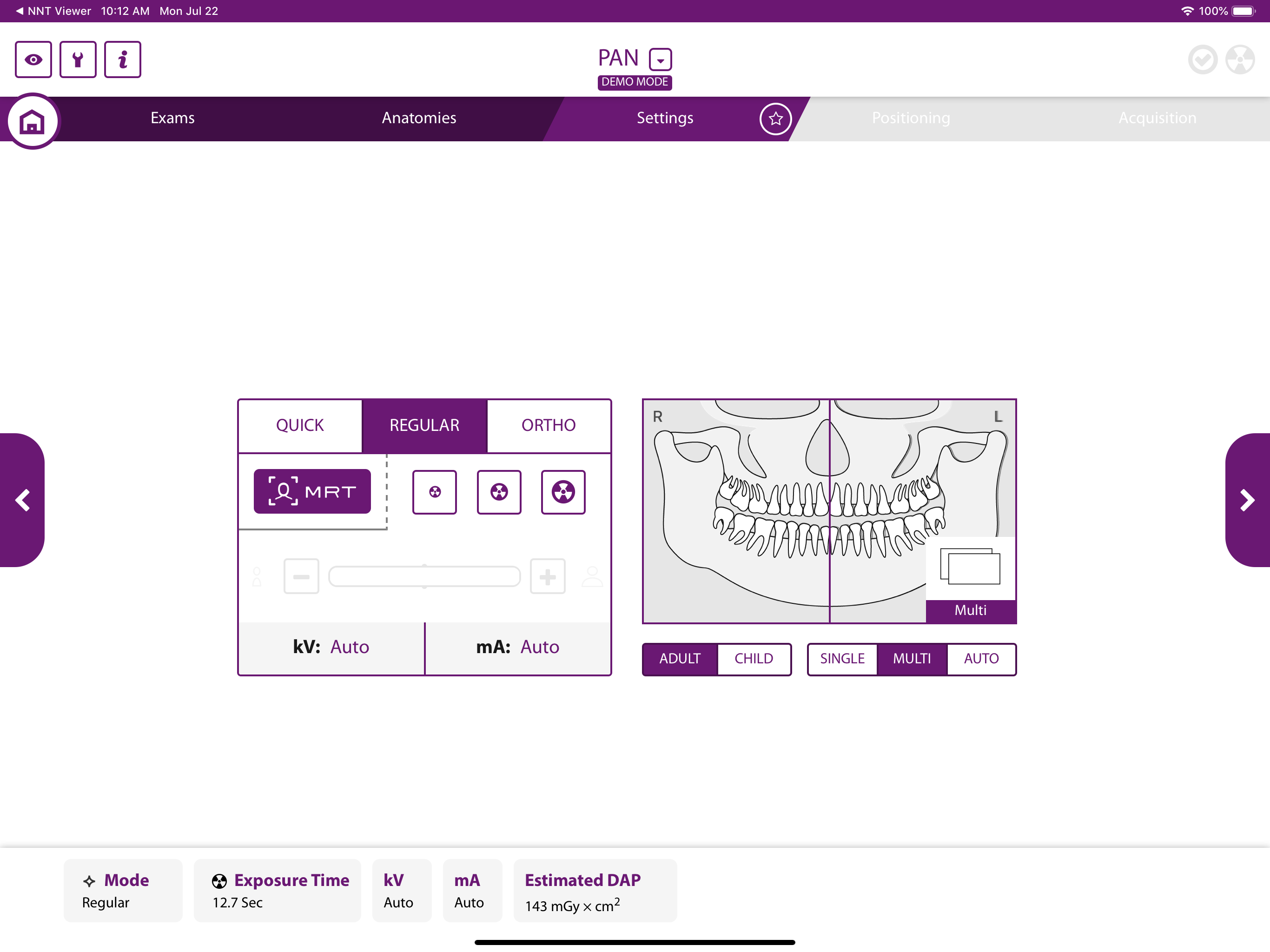 MyRay Remote Panel screenshot 5