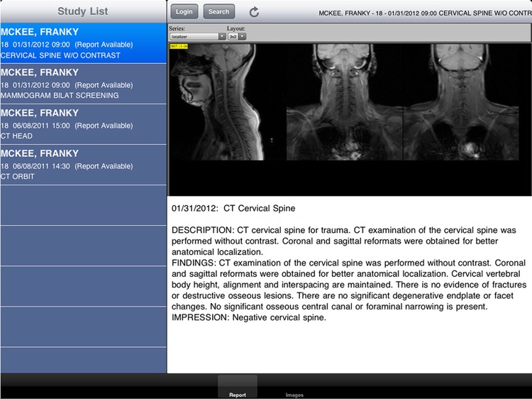 interWORKS Mobile HD