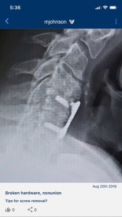Screenshot #2 pour ACES – Cervical Fusion Forum