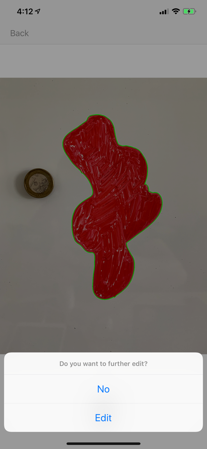 APD Skin Monitoring App