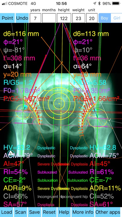 HipDysplasiaPro screenshot-3