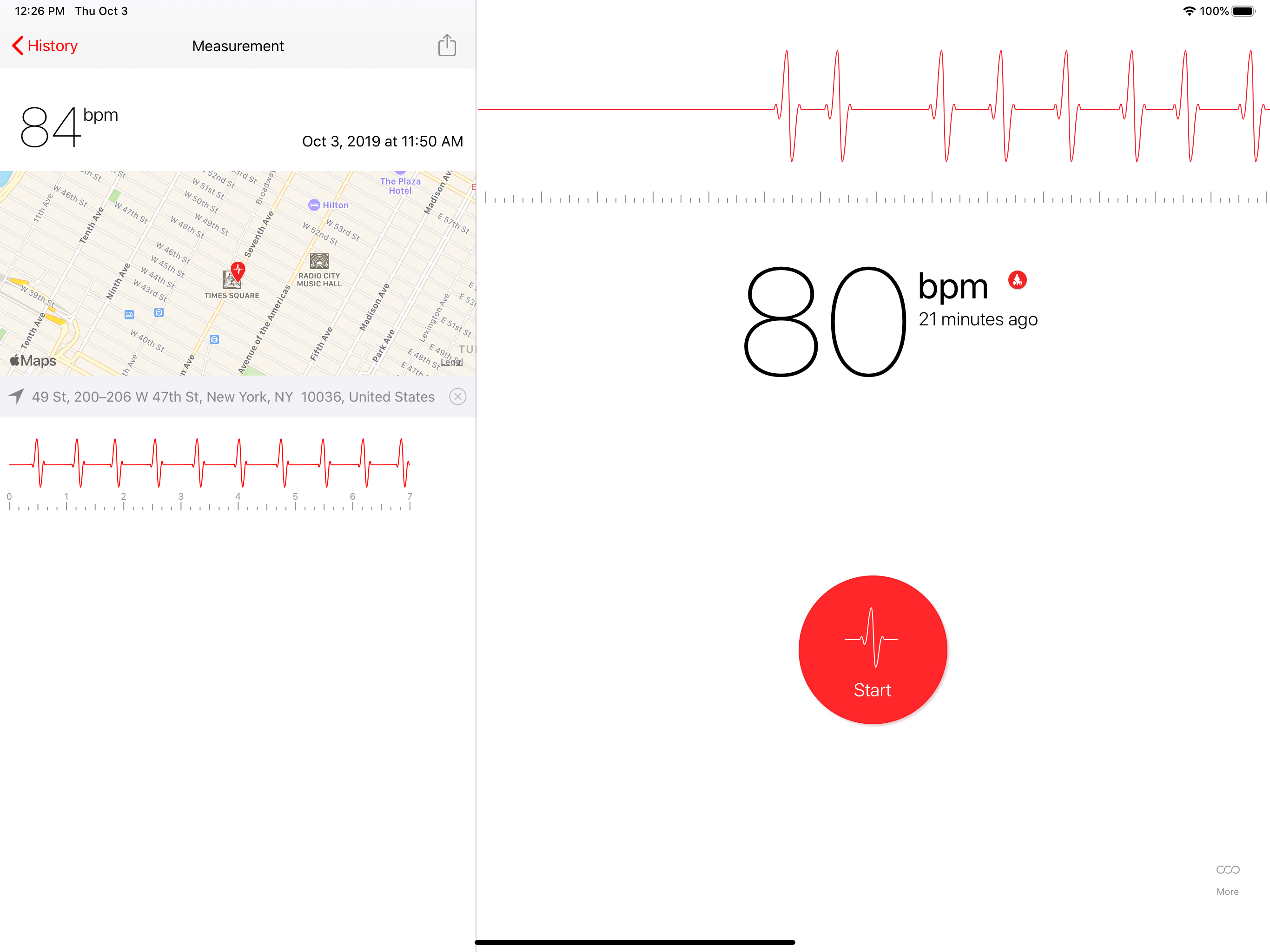 Cardiograph