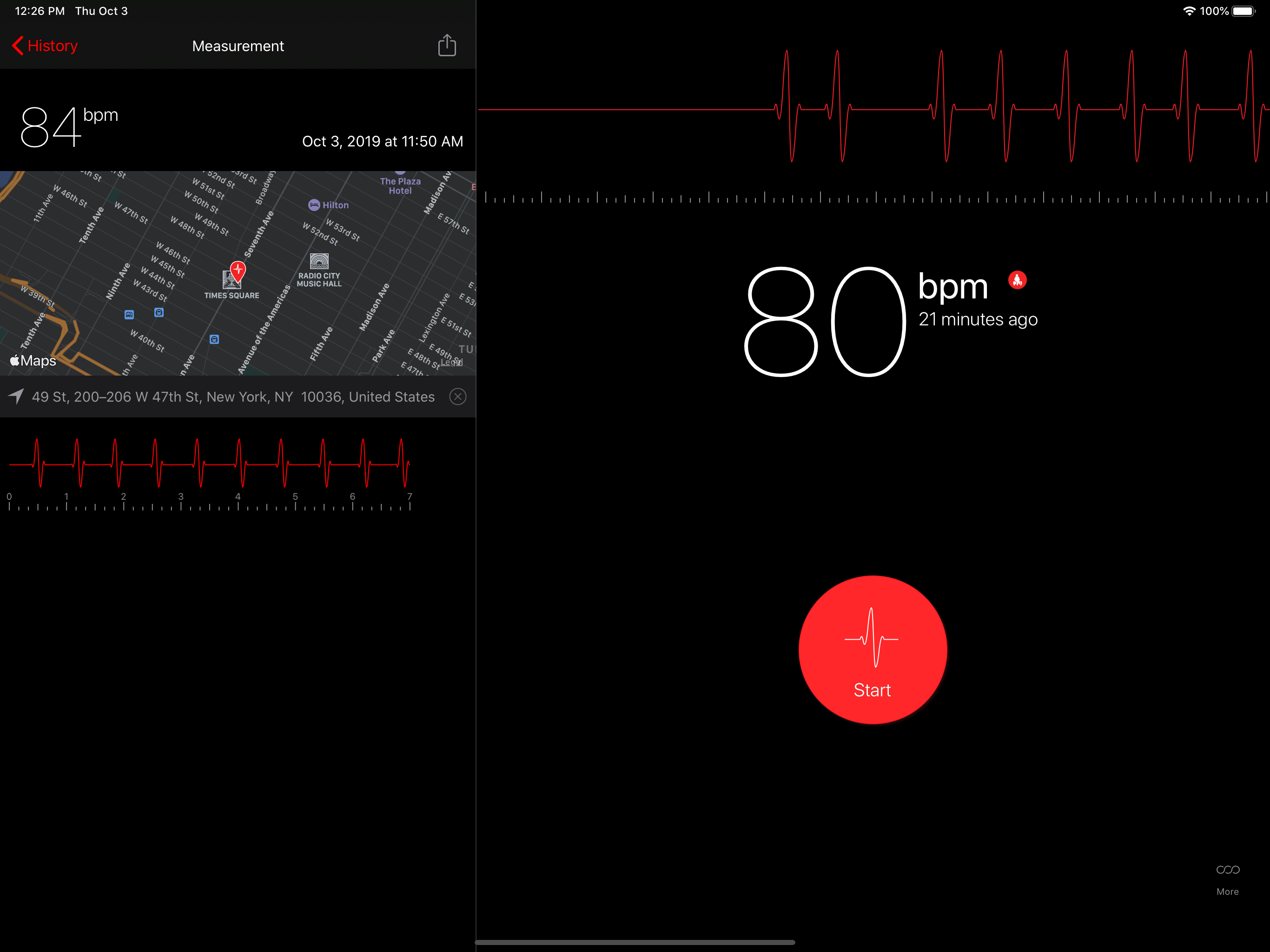 Cardiograph